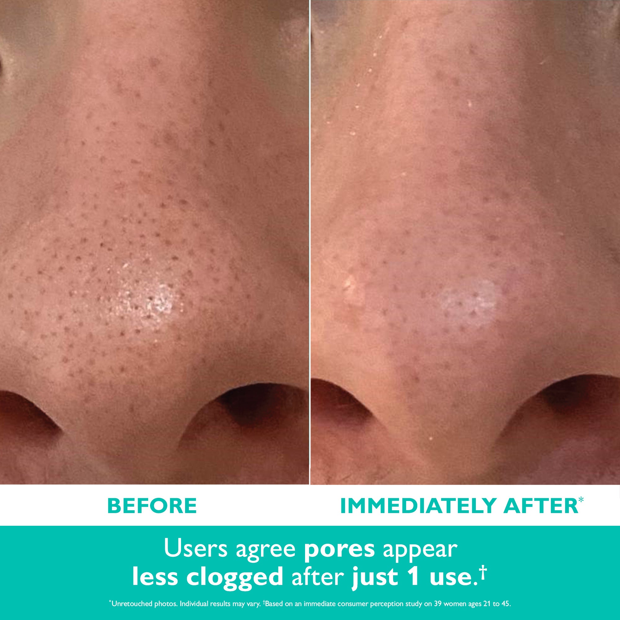 Even Smoother? Microdermabrasion Exfoliating Pore Purifier|50 ml / 1.7 fl oz - Image 2
