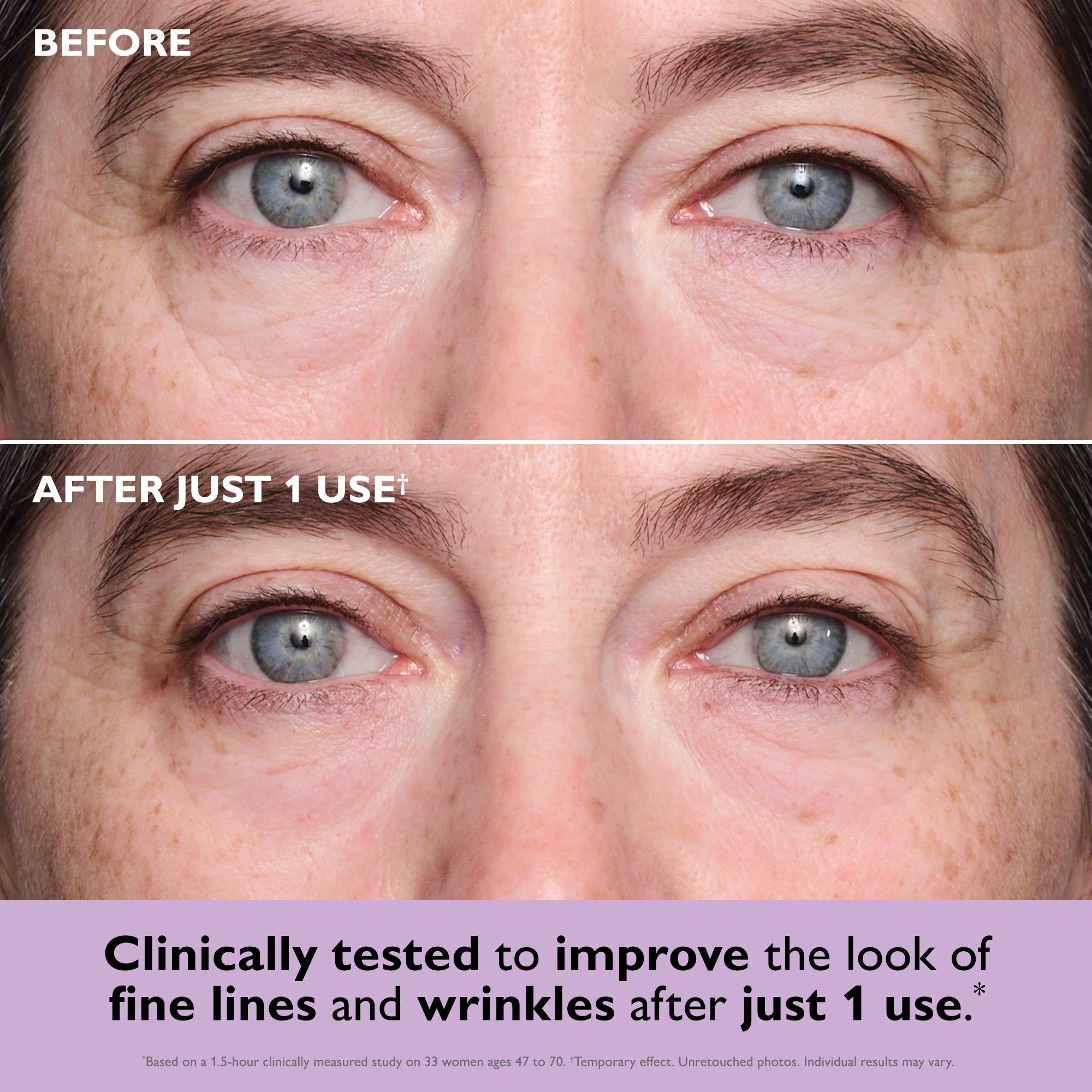 Instant FIRMx? Collagen Tightening Eye Patches - Image 2