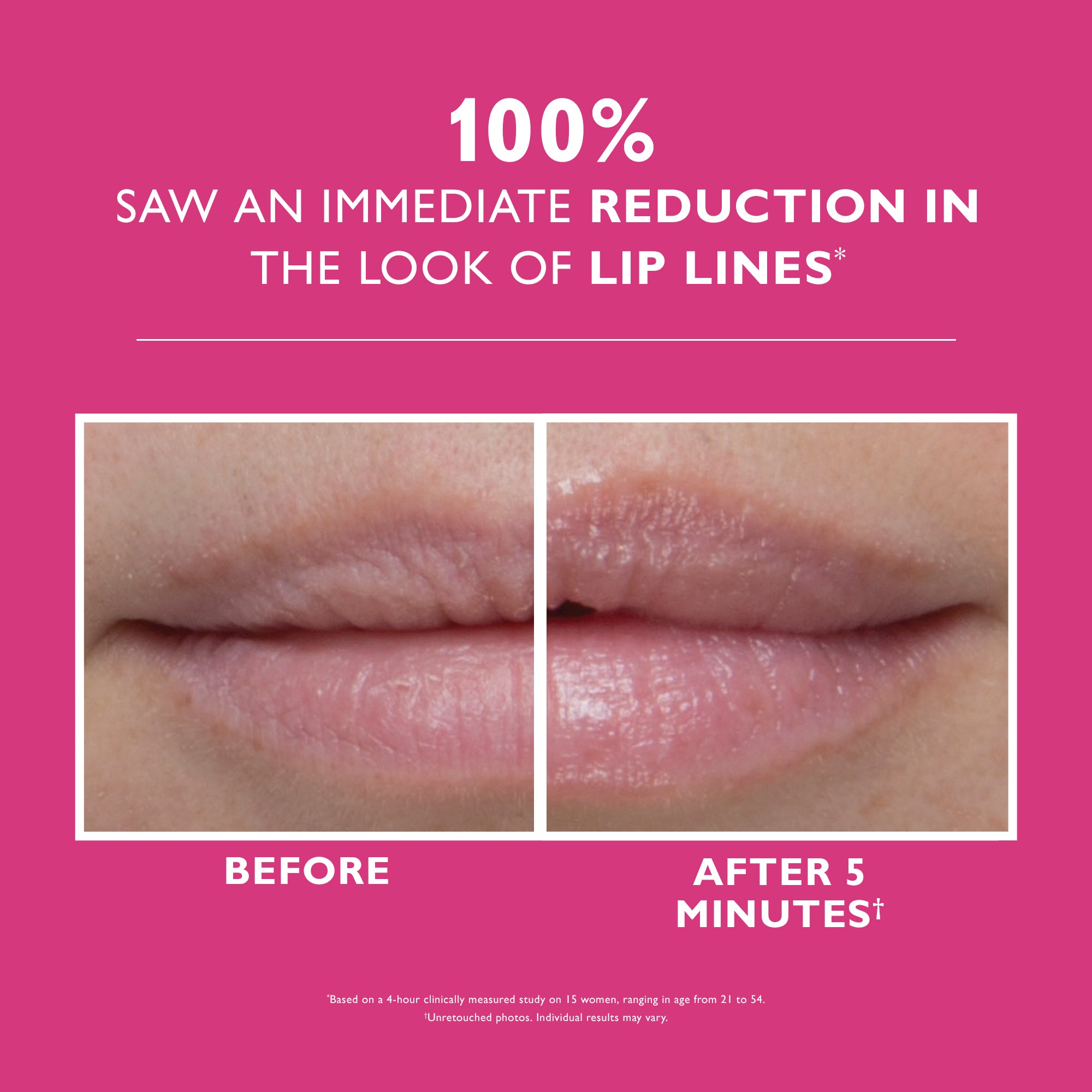 Instant FIRMx Lip Filler|10 ml / 0.3 fl oz - Image 2