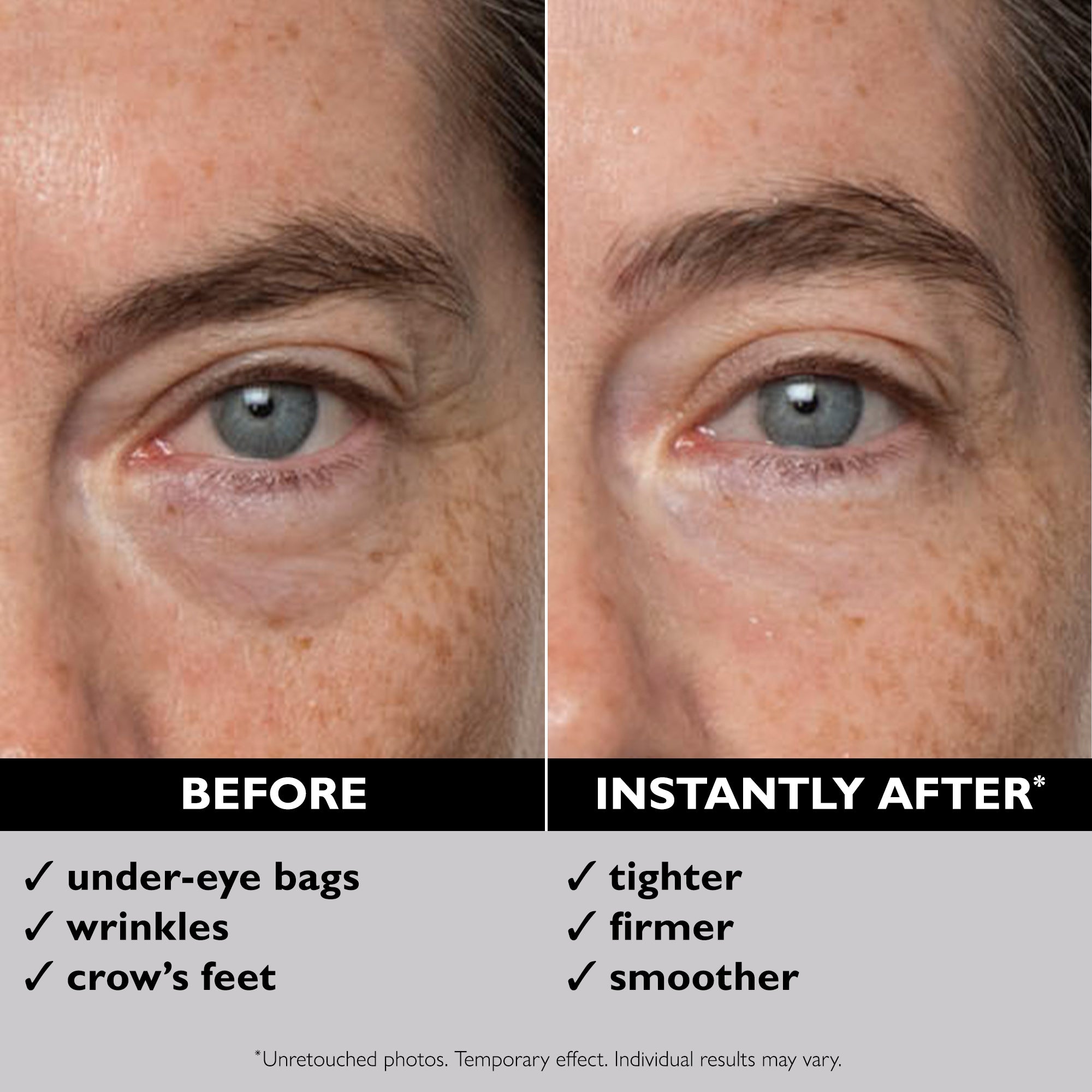 Instant FIRMx Eye Temporary Eye Tightener | 30 ml / 1.0 fl oz - Image 3