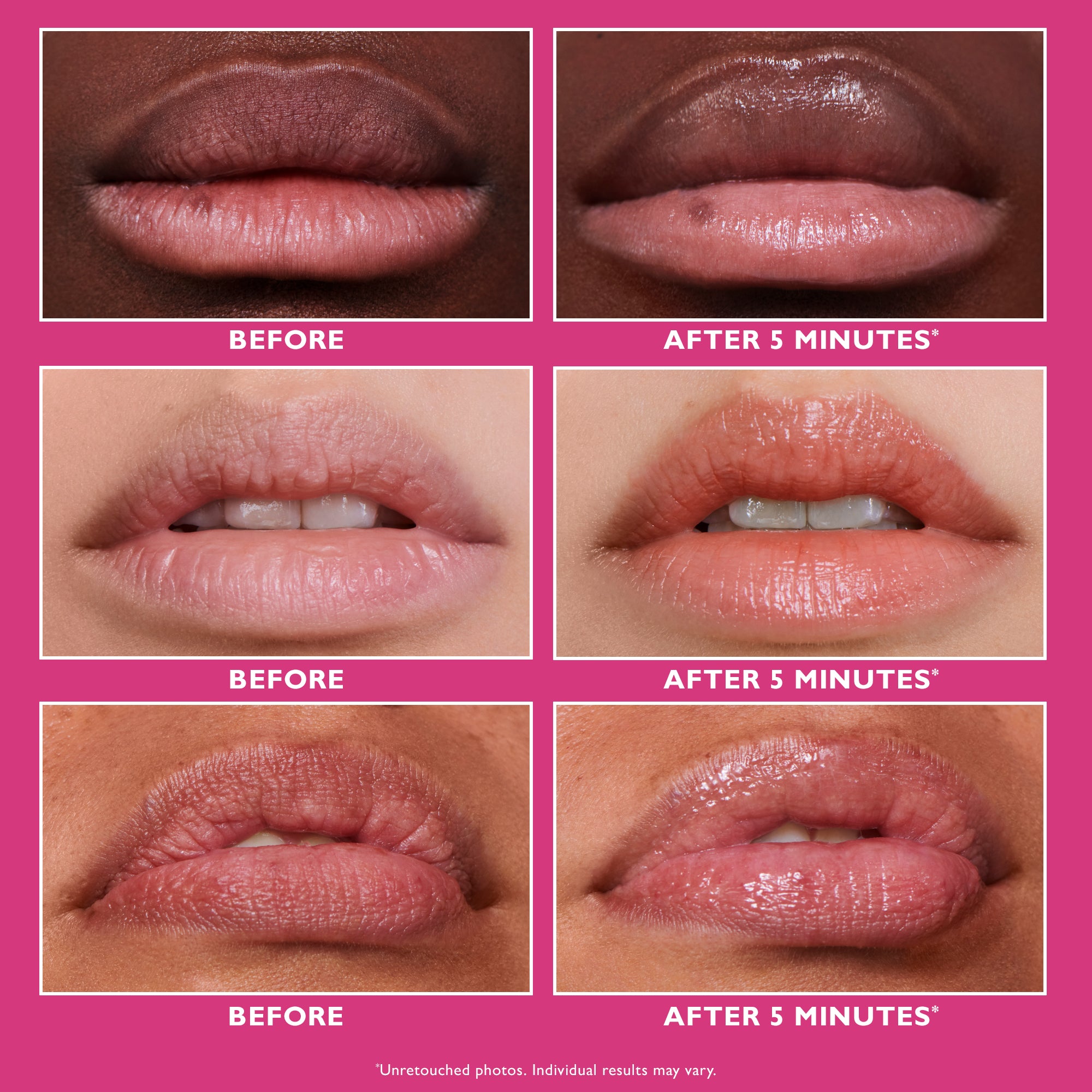 Instant FIRMx Lip Filler|10 ml / 0.3 fl oz - Image 3