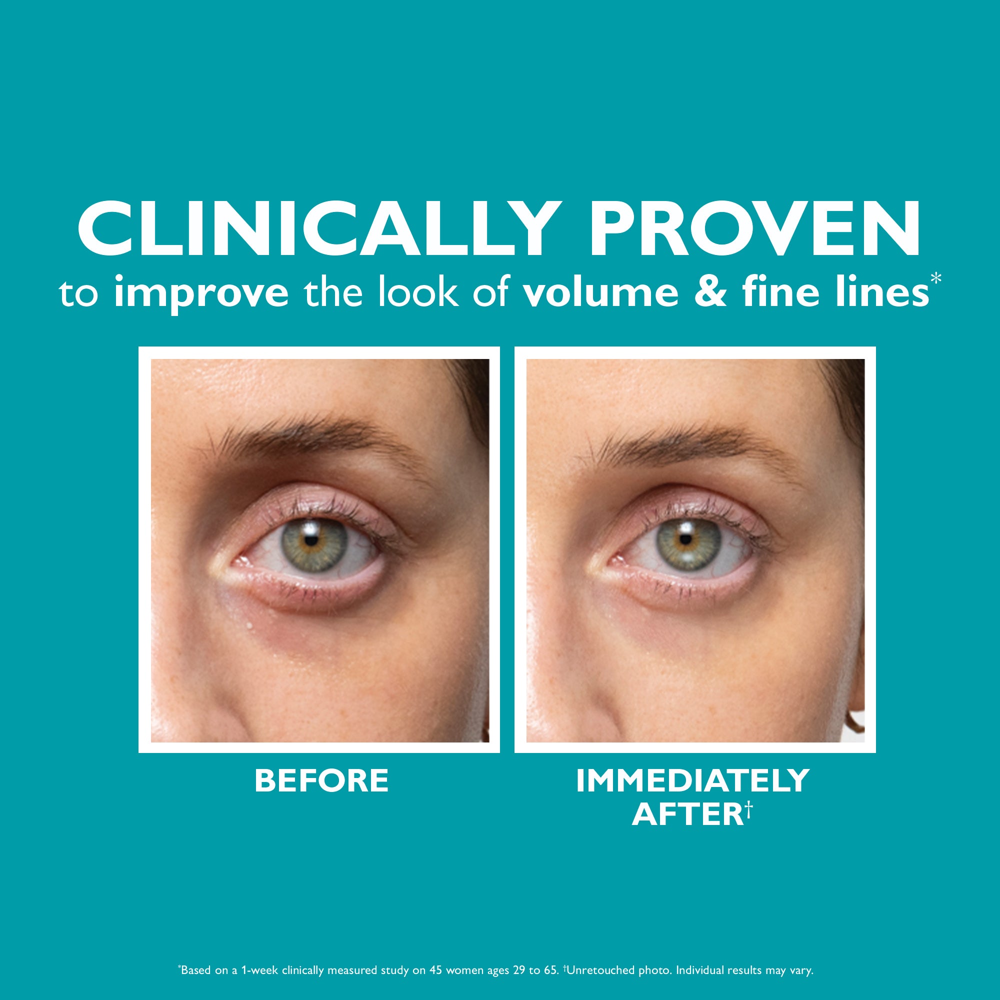 Peptide Skinjection? Fill + Fix Under-Eye Cream - Image 5