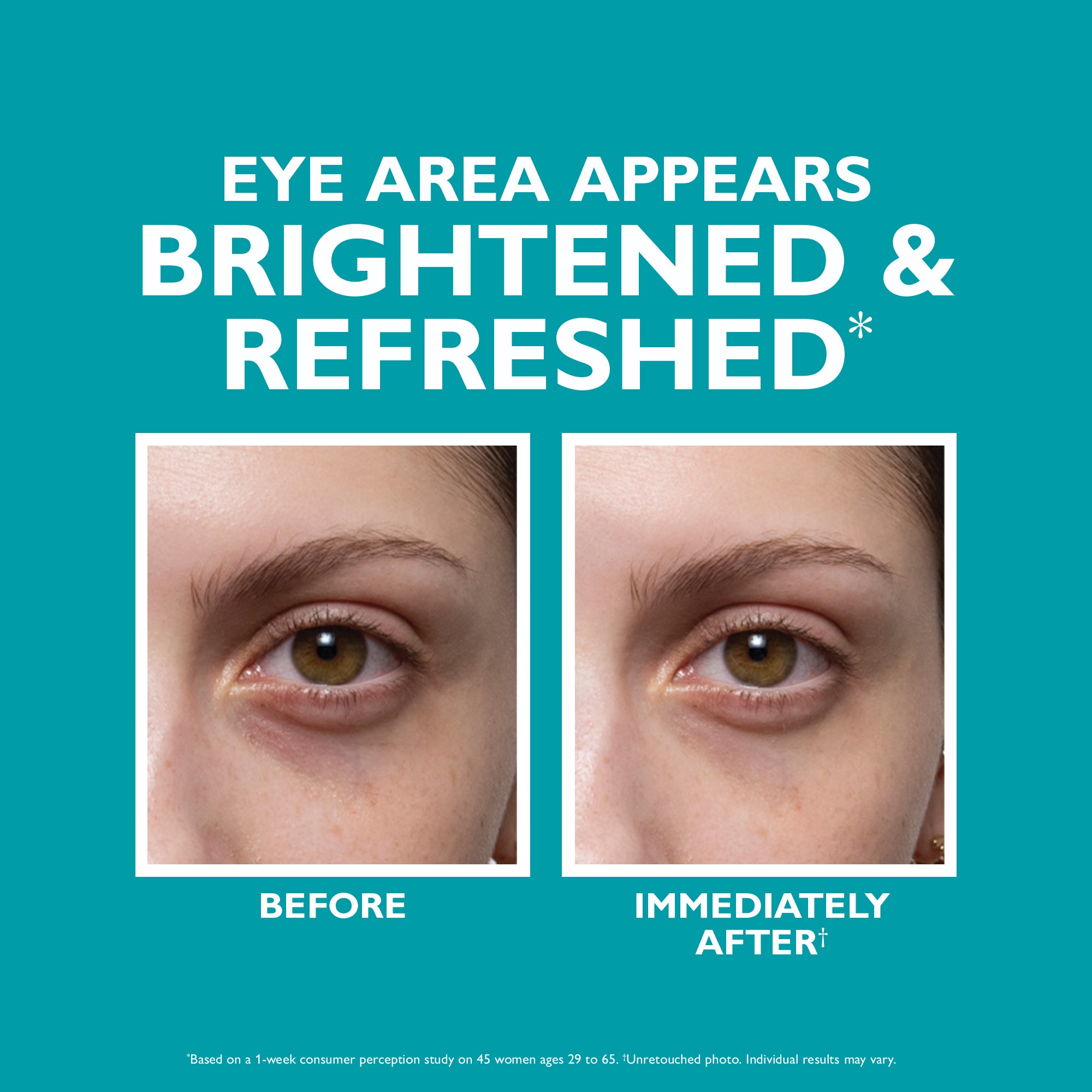 Peptide Skinjection? Fill + Fix Under-Eye Cream - Image 7