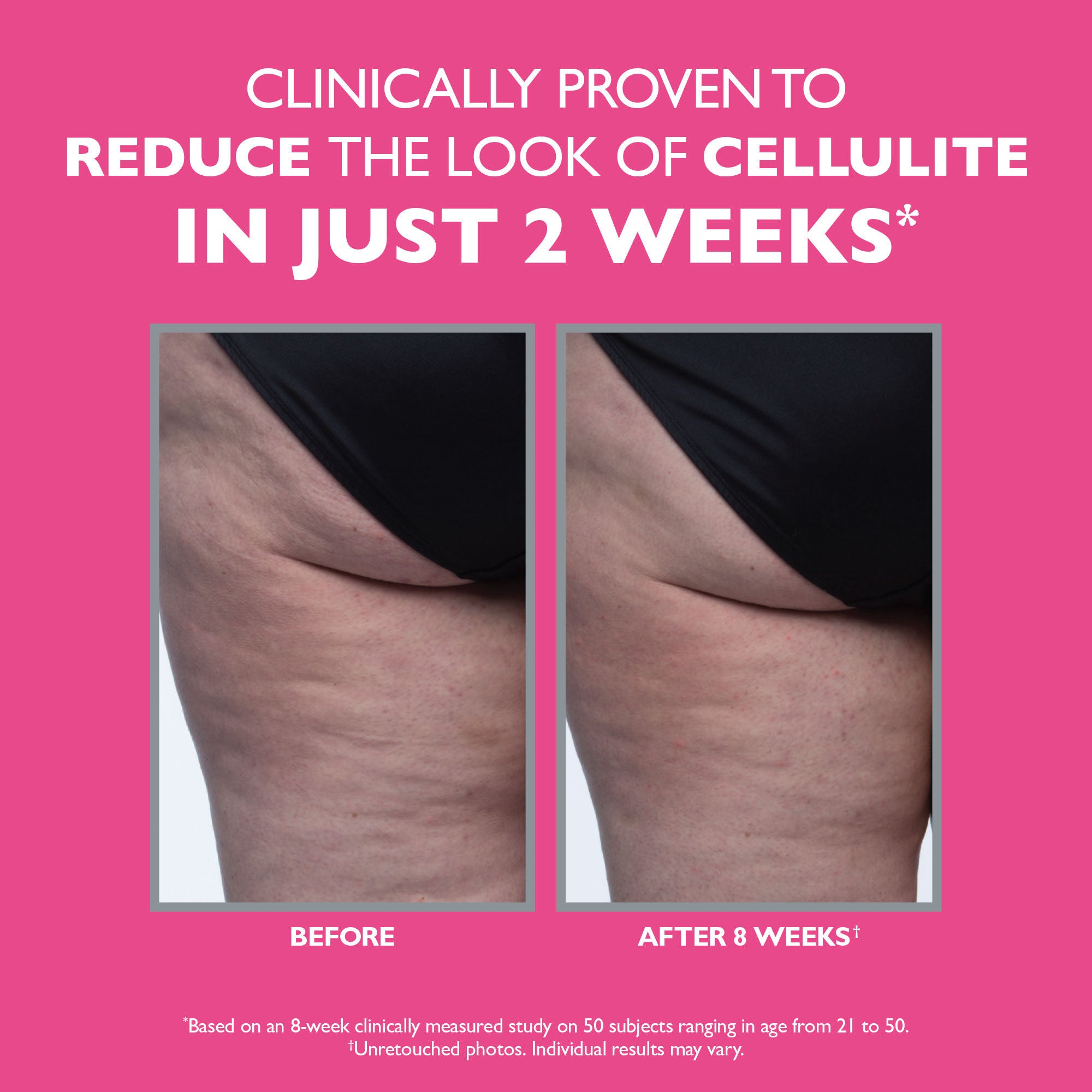 FIRMx Tight & Toned Cellulite Cream|100 ml / 3.4 fl oz - Image 4