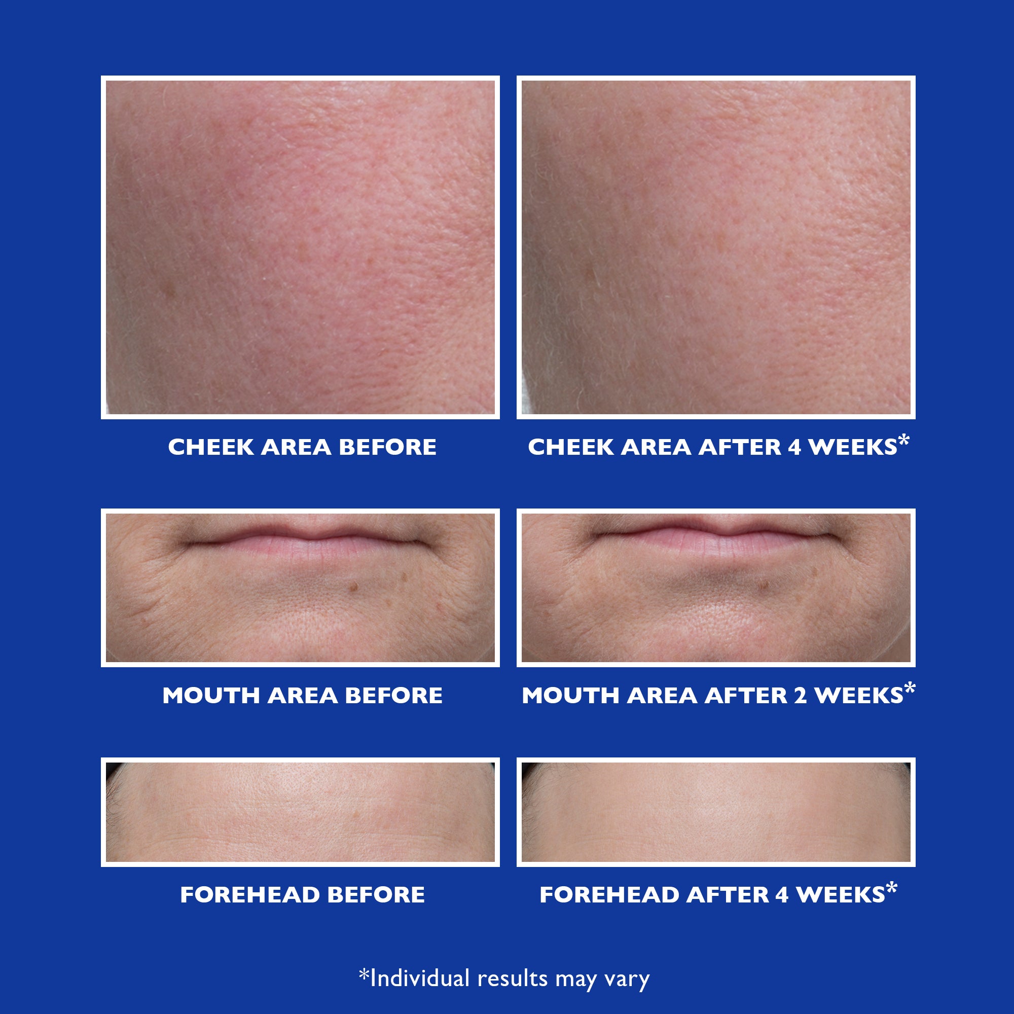 Retinol Fusion PM Night Serum|1.0 fl oz - Image 6
